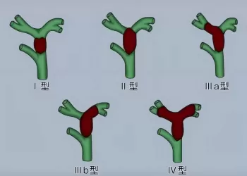 想拿钢丝球搓！女子长期熬夜吃外卖，皮肤黄、浑身痒，竟确诊“癌王”
New
