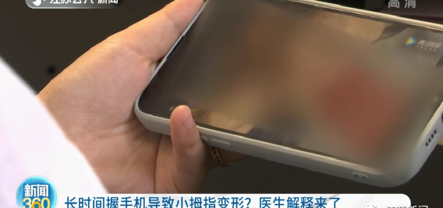 @泸州市民：你会用小拇指托住手机吗？医生提醒来了-1.png