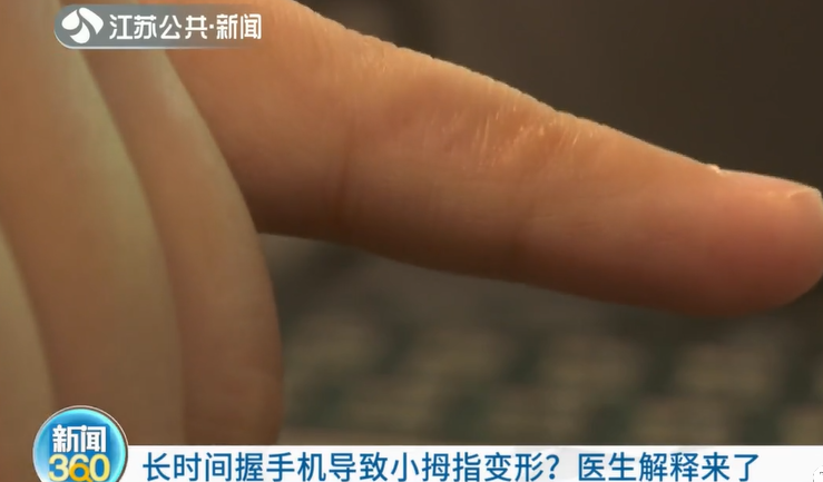 @泸州市民：你会用小拇指托住手机吗？医生提醒来了-2.png