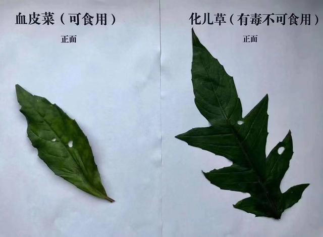 认错了“血皮菜”误食后恶心呕吐，泸州两姐妹急忙赶到医院-1.jpg