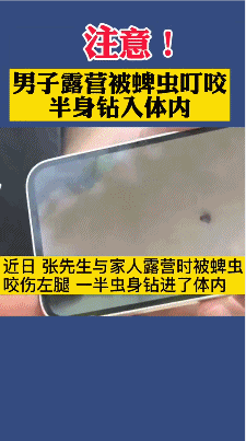 @泸州市民：夏季小心被这种“夺命虫”叮咬！多人被咬伤，严重可致命-1.png